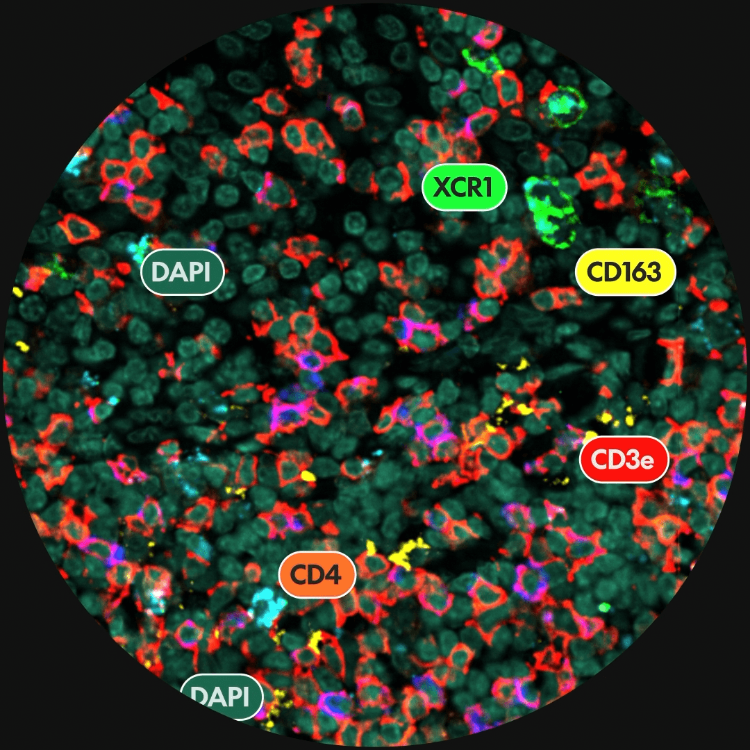 Picture of Spatial Transcriptomics